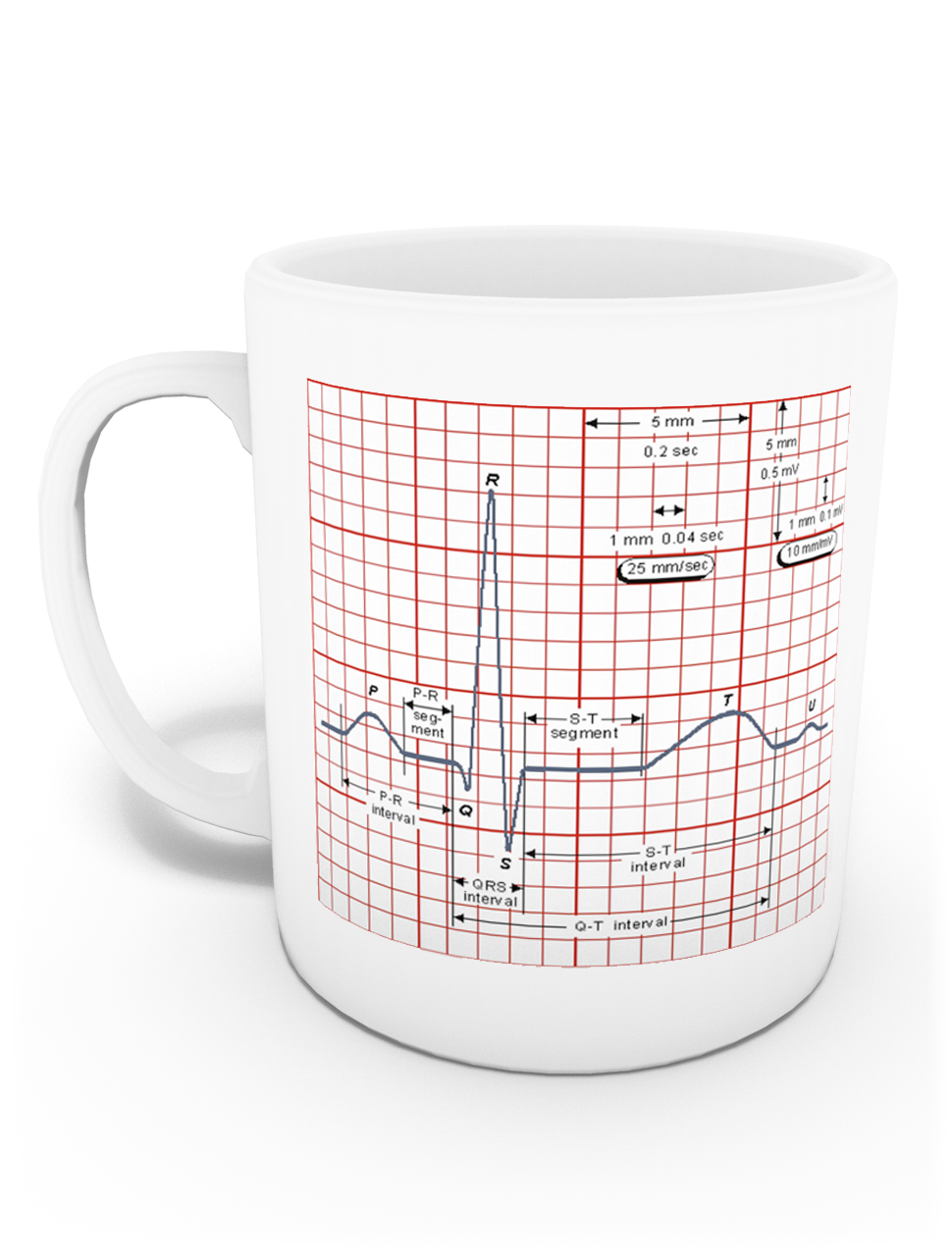 EKG Kupası (İsme Özel)