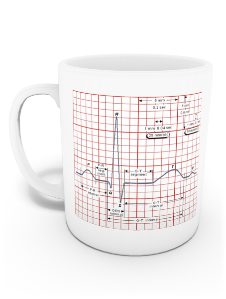 EKG Kupası (İsme Özel)