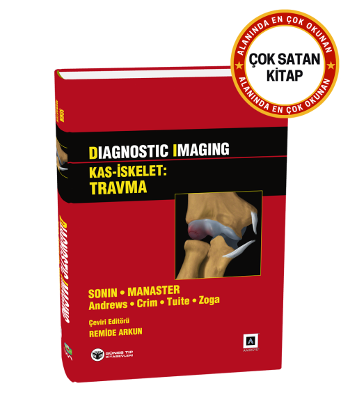 Diagnostic Imaging - Kas İskelet: Travma