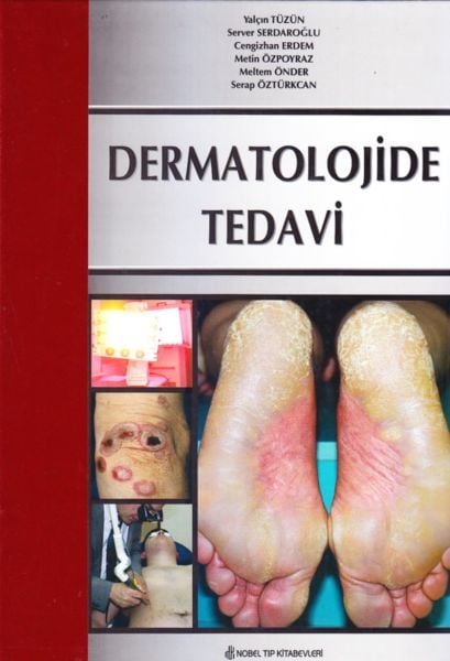 Dermatolojide Tedavi