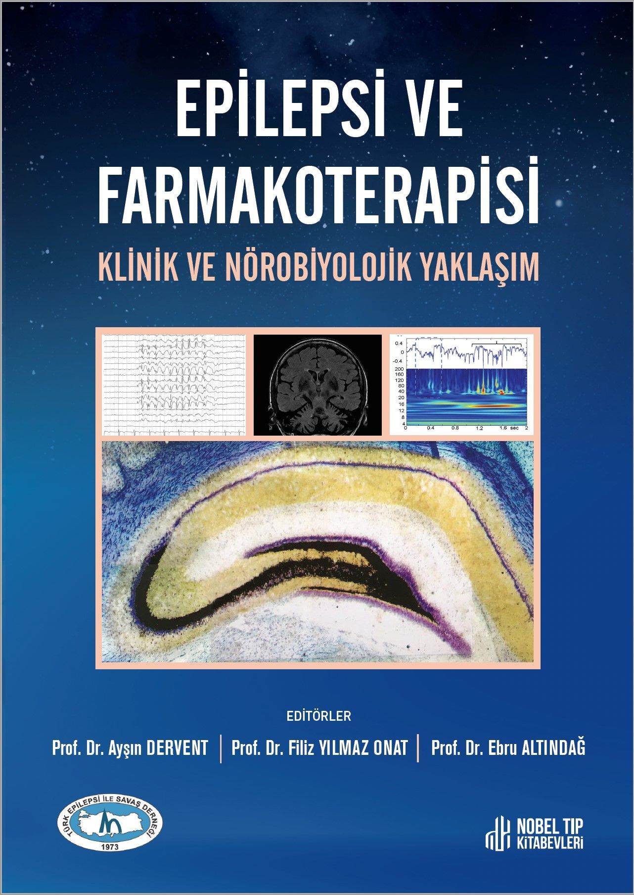 Epilepsi ve Farmakoterapisi Klinik ve Nörobiyolojik Yaklaşım