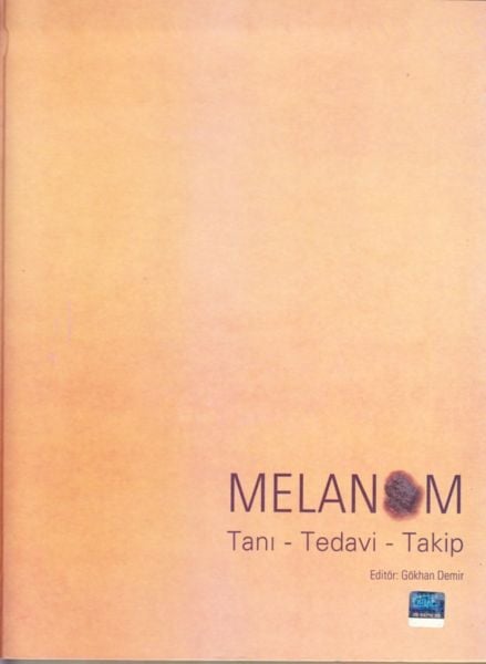 Melanom Tanı - Tedavi - Takip